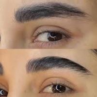 بهترین کلینیک لیفت ابرو با نخ در قائمشهر