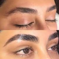 بهترین کلینیک لیفت ابرو با نخ در قائمشهر