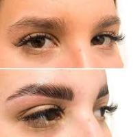 بهترین کلینیک لیفت ابرو با نخ در قائمشهر