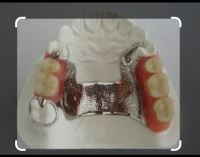 پارسیل کرم کبالت فک بالا