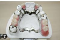 پارسیل کرم کبالت فک بالا