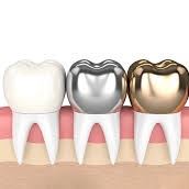 ارزان ترین دندانپزشکی در یزد