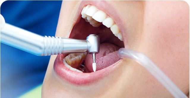 ارزانترین دندانپزشکی در یزد