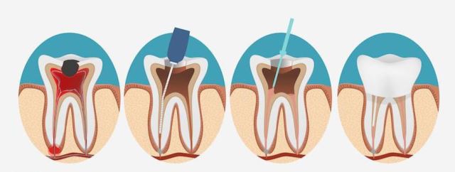 ارزان ترین دندانپزشکی در یزد