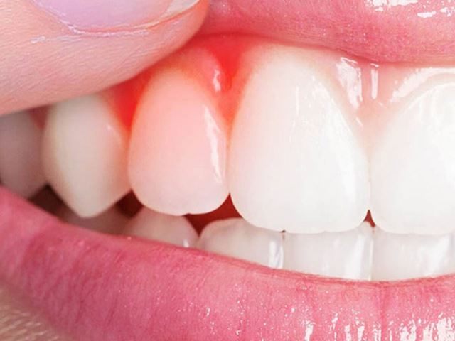 ارزان ترین دندانپزشکی در یزد