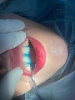 ارزان ترین دندانپزشکی در یزد