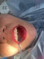 ارزان ترین دندانپزشکی در یزد