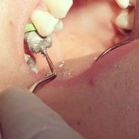 ارزان ترین دندانپزشکی در یزد