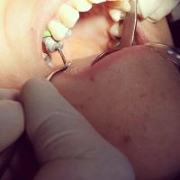 ارزان ترین دندانپزشکی در یزد