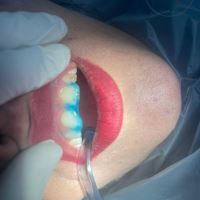 ارزان ترین دندانپزشکی در یزد