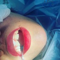 ارزان ترین دندانپزشکی در یزد