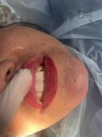 ارزان ترین دندانپزشکی در یزد