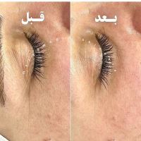 بهترین مرکز فیشیال پوست در اصفهان