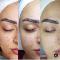 مرکز فیشیال پوست در شهرکرد