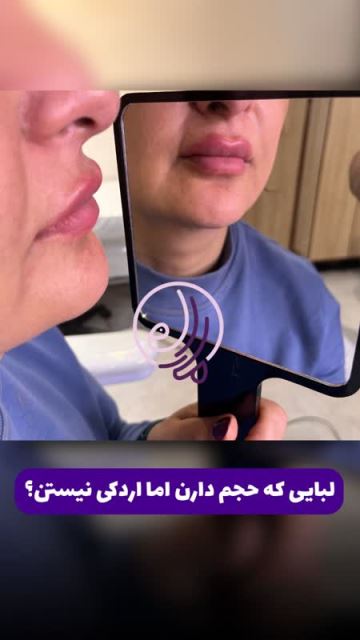 بلفاروپلاستی در شهرک گلستان