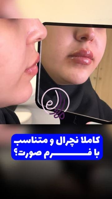 بهترین بلفاروپلاستی در شهرک گلستان