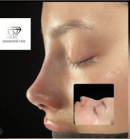 عمل بینی استخوانی در ولیعصر