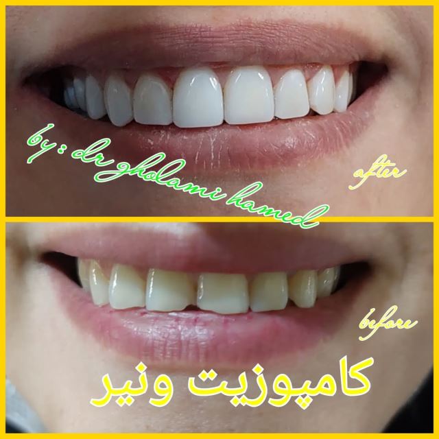 بهترین دندانپزشک در شهرک غرب تهران 