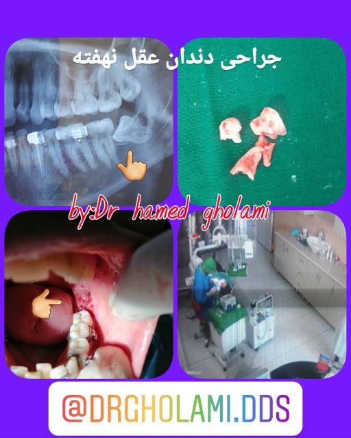 بهترین دندانپزشک در شهرک غرب تهران 