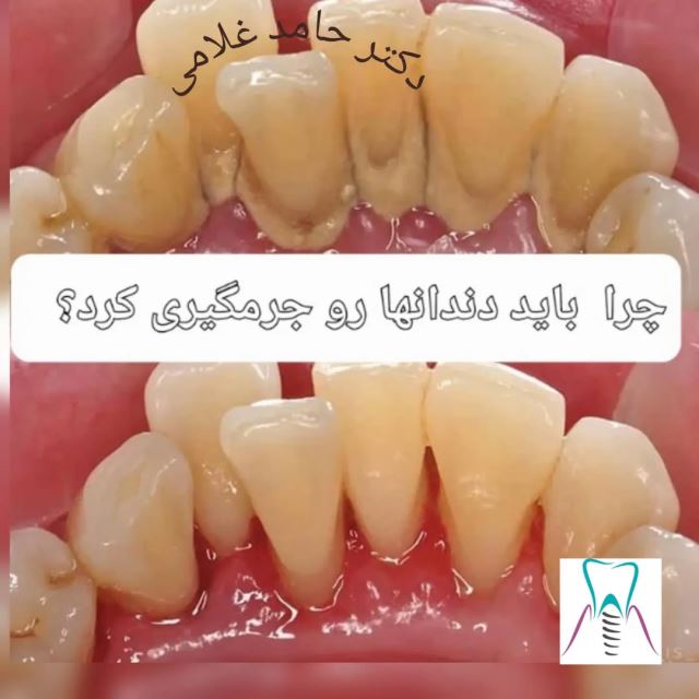 بهترین دندانپزشک در شهرک غرب تهران 