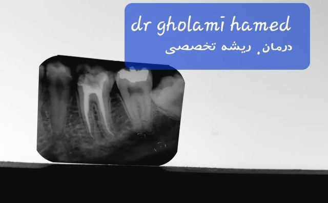 بهترین دندانپزشک در شهرک غرب تهران 