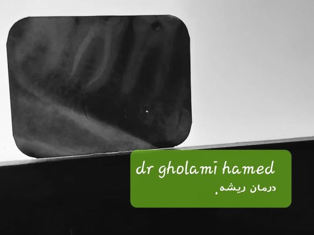 بهترین دندانپزشک در شهرک غرب تهران 