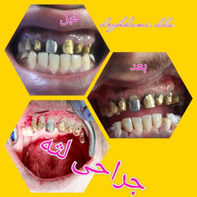 بهترین دندانپزشک در شهرک غرب تهران 