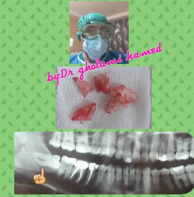 بهترین دندانپزشک در شهرک غرب تهران 