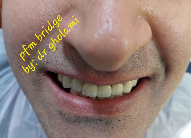 بهترین دندانپزشک در شهرک غرب تهران 