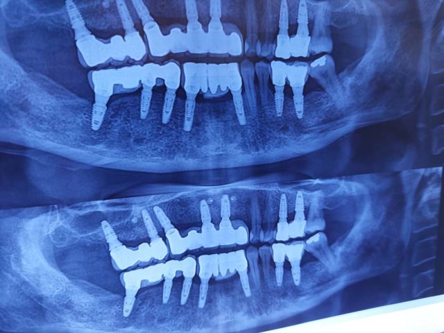 بهترین دندانپزشک در شهرک غرب تهران 