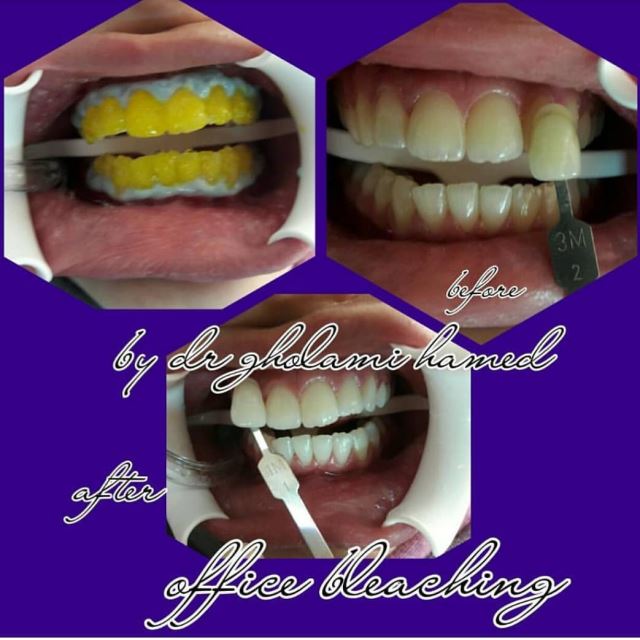 بهترین دندانپزشک در شهرک غرب تهران 