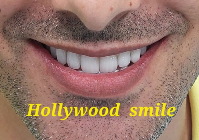 بهترین دندانپزشک در شهرک غرب تهران 