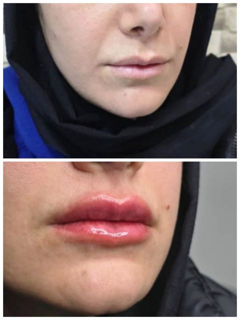 بهترین کلینیک زیبایی در شاهین شهر