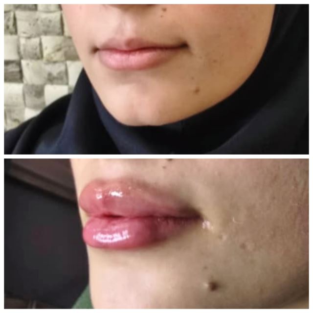 بهترین کلینیک زیبایی در شاهین شهر