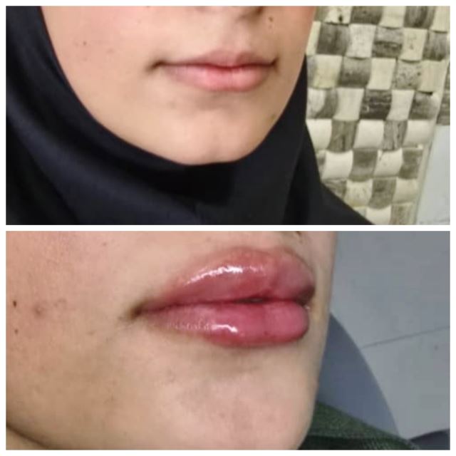 بهترین کلینیک زیبایی در شاهین شهر