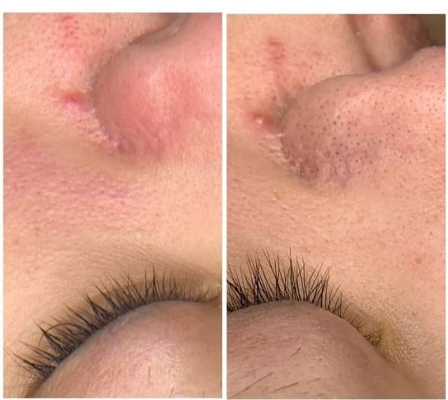 بهترین مرکز فیشیال و پاکسازی پوست در تهران 