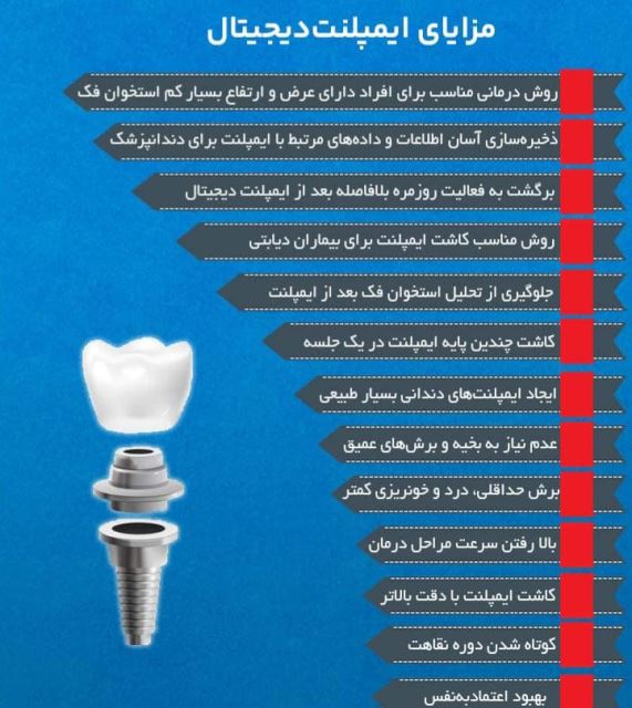 ایمپلنت فوری در تبریز