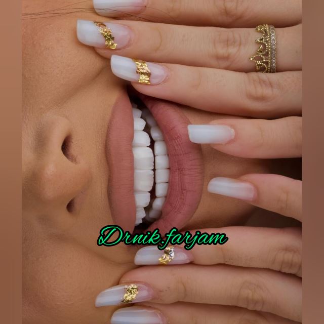 بهترین دندانپزشک نجف آباد