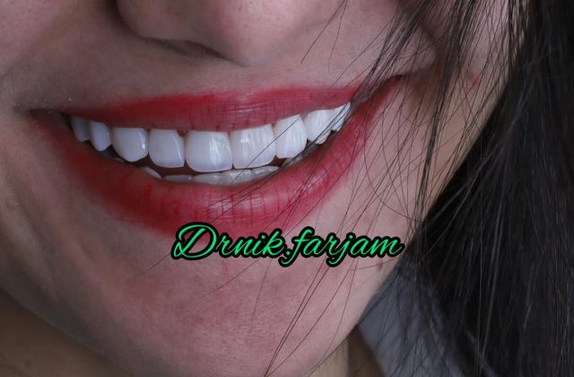 بهترین دندانپزشک نجف آباد