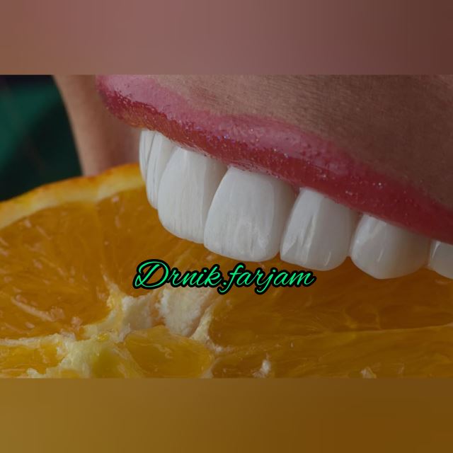 بهترین دندانپزشک نجف آباد