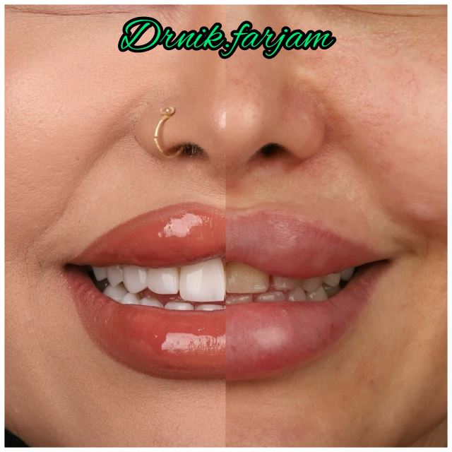 بهترین دندانپزشک نجف آباد