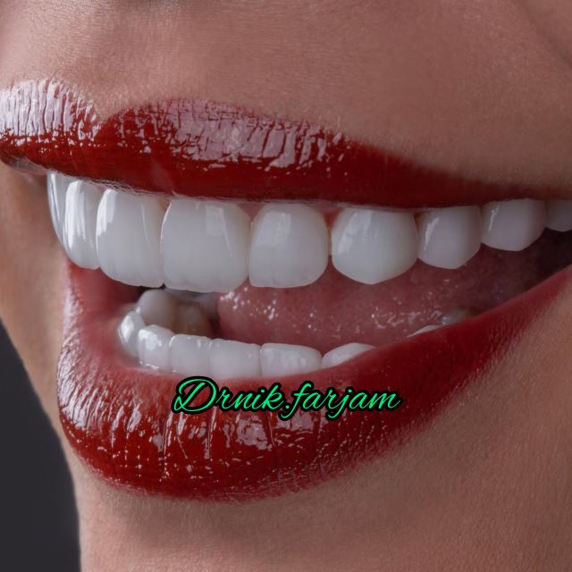 بهترین دندانپزشک نجف آباد