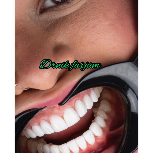 بهترین دندانپزشک نجف آباد