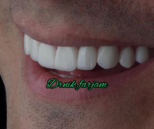 بهترین دندانپزشک نجف آباد