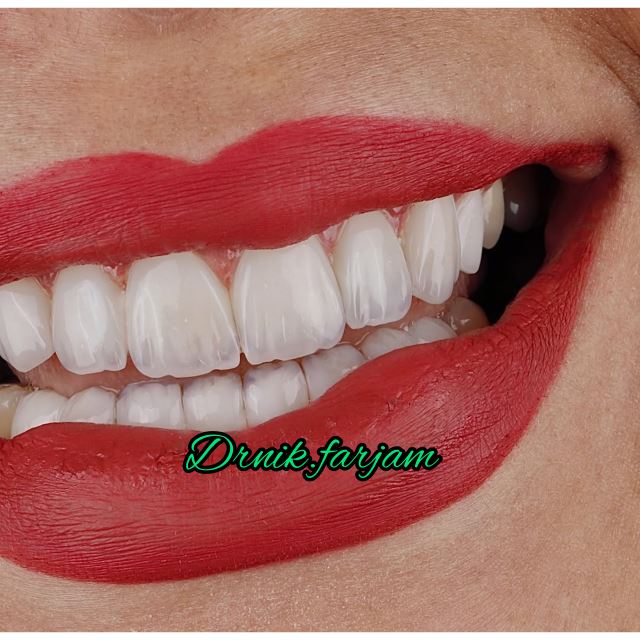 بهترین دندانپزشک نجف آباد