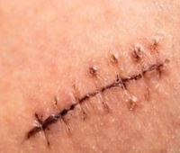 خدمات پرستاری و پزشکی در منزل نیاوران