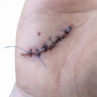 خدمات پرستاری در منزل تجریش