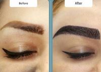 کلینیک کاشت ابرو در شیراز