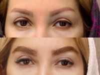 کلینیک کاشت ابرو در شیراز