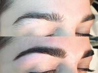 کلینیک کاشت ابرو در شیراز